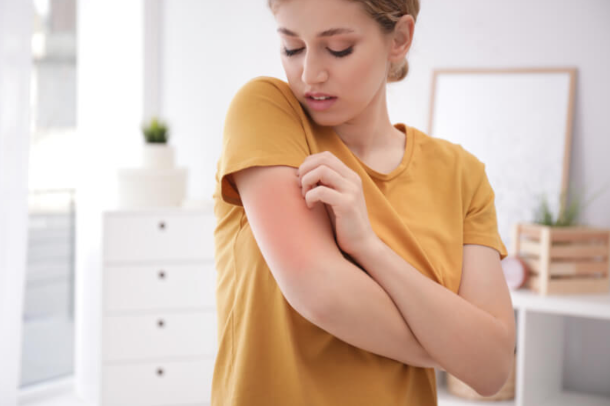 Woman noticing irritation on arm