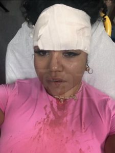 A photo of Bryhana Monegain at the hospital showing a bandage on her forehead after being assaulted by 50 cent.