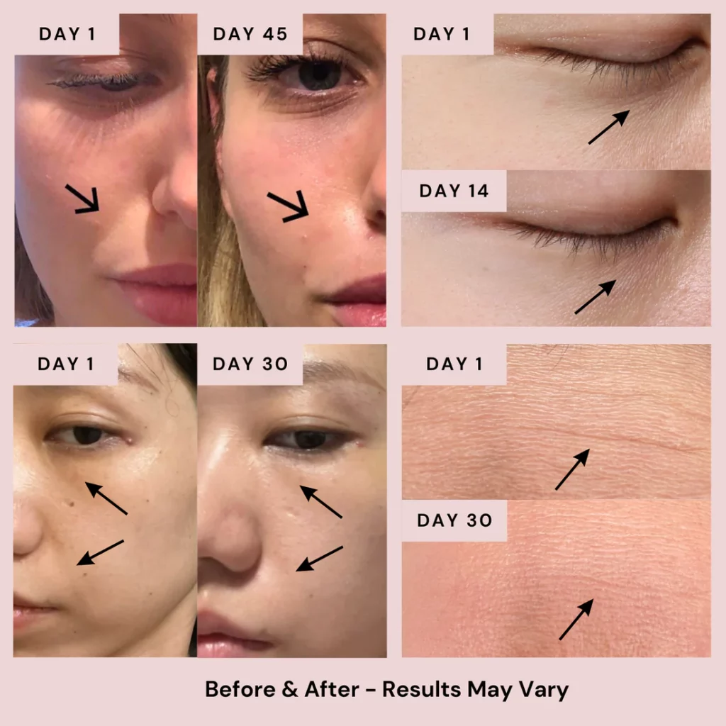 Hydrating serum results before and after