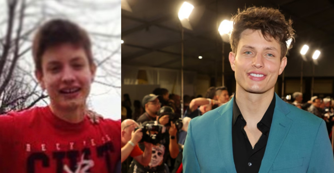 Matt Rife jaw before and after