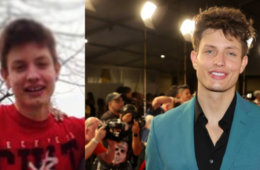 Matt Rife Before Fake Teeth