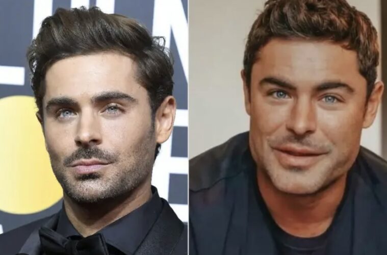 Zac Efron Before and After the Accident