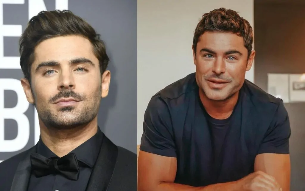 Zac Efron Accident Face Surgery