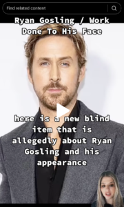 Did Ryan Gosling Get Work Done To His Face?
