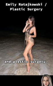 Emily Ratajkowski Plastic Surgery