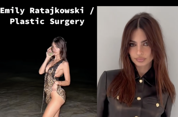 Emily Ratajkowski Plastic Surgery Rumors