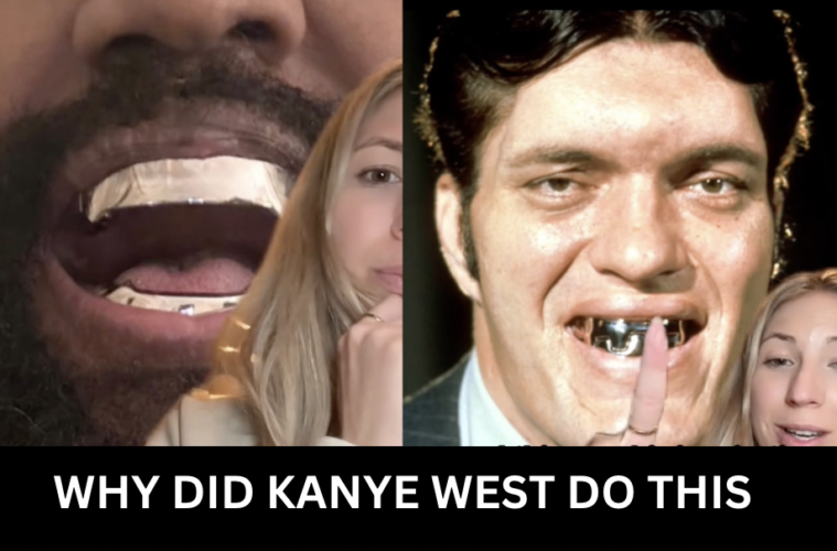 What Did Kanye West Do To His Teeth