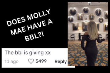 Does Molly Mae Have A BBL?