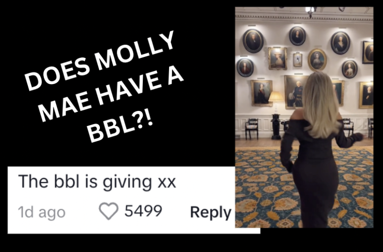 Does Molly Mae Have A BBL?