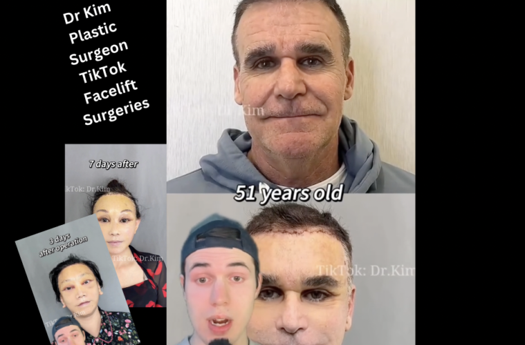 Who Is Dr Kim Plastic Surgeon TikTok Alleged Botched Facelift Surgeries?