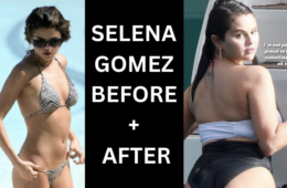 Selena Gomez Body Before and After