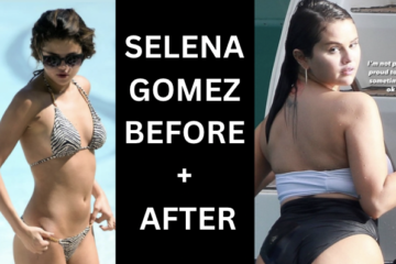Selena Gomez Body Before and After