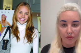 Amanda Bynes Before and After