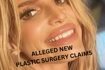 Will Alleged Plastic Surgery Keep Jessica Simpson Young?