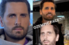 What Is Ozempic Face Hollywood Before and After Celebrities