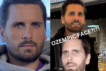 What Is Ozempic Face Hollywood Before and After Celebrities