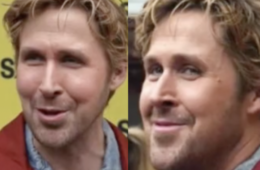 What Happened To Ryan Gosling Face Filler Rumor