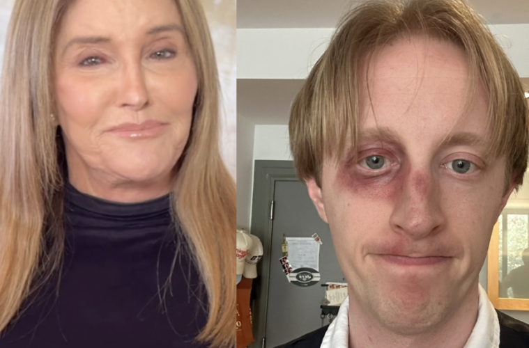 Did Caitlyn Jenner Punch Dan Carney Comedian?