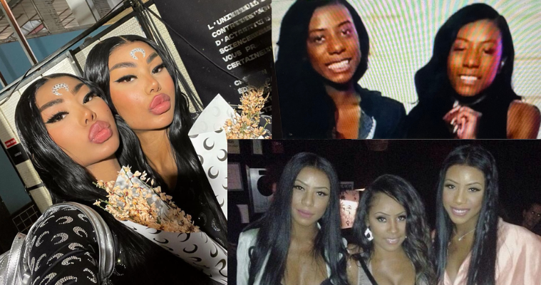 Clermont Twins before surgery