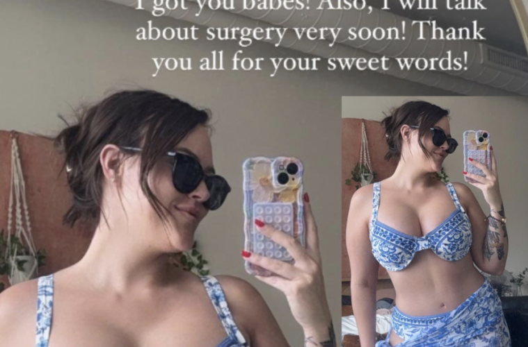 Chelsea Love is Blind Weight Loss Surgery Tummy Tuck?