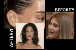 Kylie Jenner Facelift Proof?