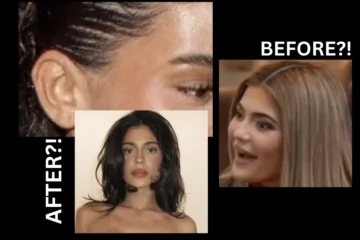 Kylie Jenner Facelift Proof?