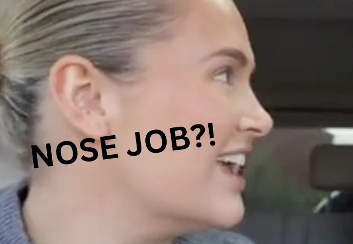Molly Mae Nose Job Addressed