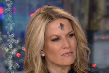 what is on martha maccallum's forehead