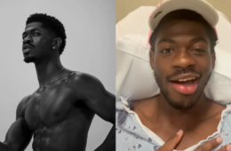 What Caused Lil Nas X's Facial Paralysis?
