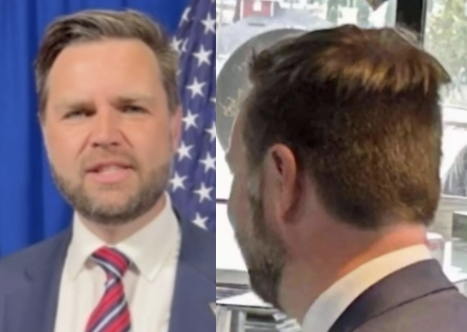 JD Vance Hair Transplant Rumor Explained