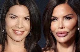 Lauren Sanchez Plastic Surgery Then and Now Revealed