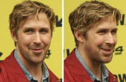 Ryan Gosling Plastic Surgery