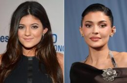 Kylie Jenner Shares Details of Cosmetic Procedures