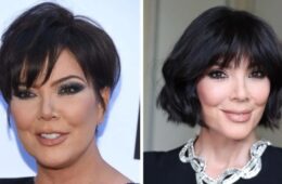 Kris Jenner Breaks Silence on Viral Facelift