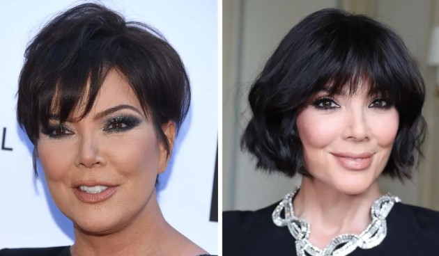 Kris Jenner Breaks Silence on Viral Facelift