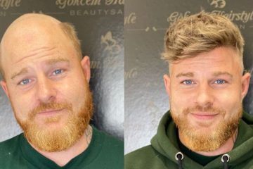 hair system cost: before and after wearing a hair system