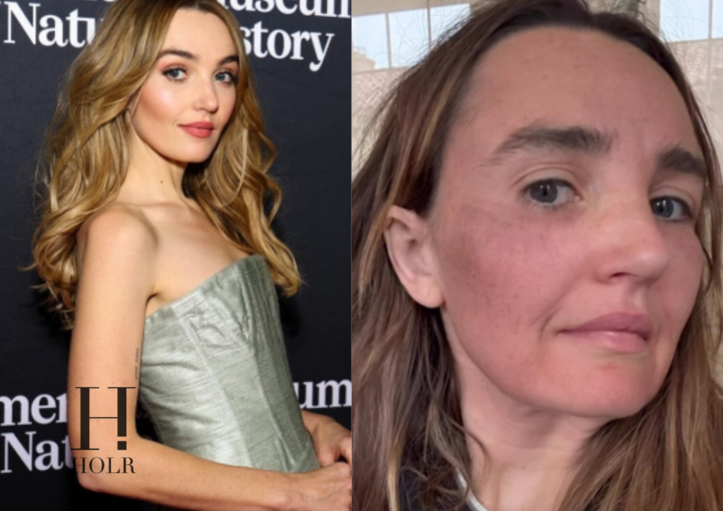Chloe Fineman Shares ‘Botched’ iPhone Photos of Cosmetic Procedures – Chloe Fineman Shares ‘Botched’ iPhone Photos of Cosmetic Procedures –