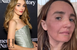 Chloe Fineman Shares ‘Botched’ iPhone Photos of Cosmetic Procedures