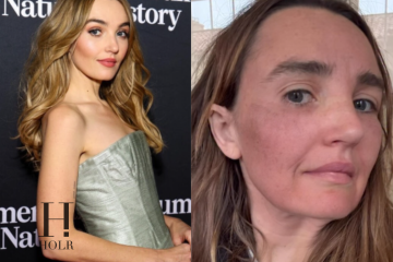 Chloe Fineman Shares ‘Botched’ iPhone Photos of Cosmetic Procedures