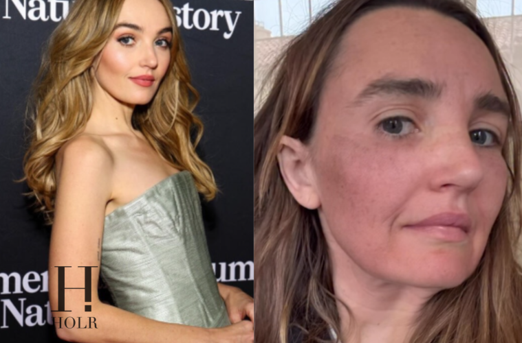 Chloe Fineman Shares ‘Botched’ iPhone Photos of Cosmetic Procedures
