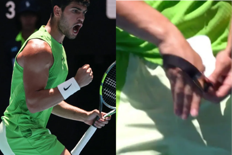 Umpire orders Alcaraz to remove Whoop bracelet –