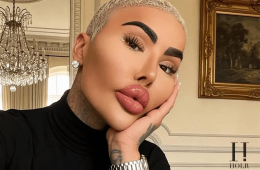 Jordan James Parke Dies After Reported Cosmetic Procedure