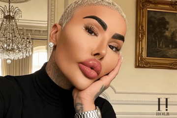 Jordan James Parke Dies After Reported Cosmetic Procedure