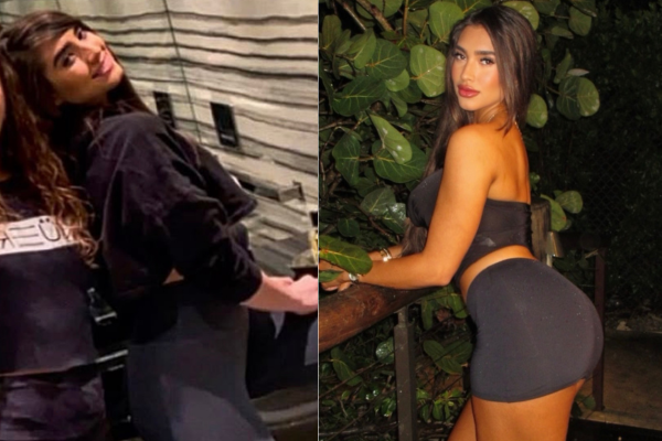 Love Island Parmida Before and After Plastic Surgery